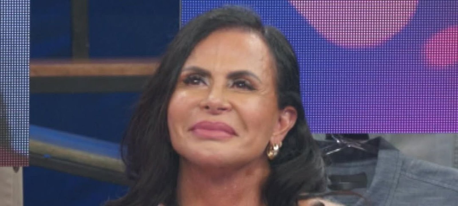 Especialista detalha cuidados na nova harmonização facial de Gretchen - Imagem do artigo
